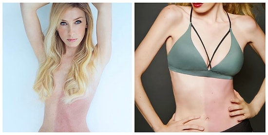 Сама себе сестра-близнец: история девушки-химеры, которая работает фотомоделью