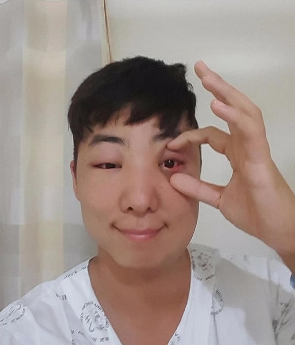 14. Уже лучше, я могу приоткрыть глаз!