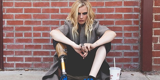 Успешная модель лишилась ноги из-за обычного тампона, а теперь может потерять и вторую