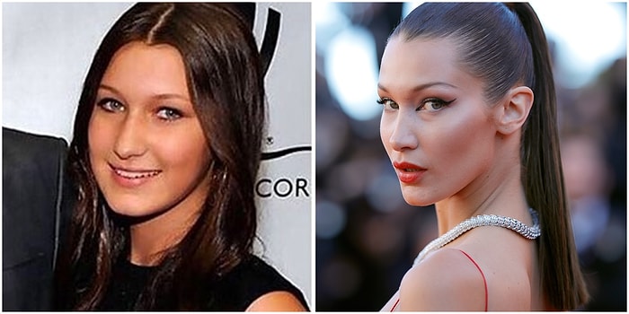 Bu Ünlülerden Hangisinin Burun Estetiği Olmadığını Bulabilecek misin?