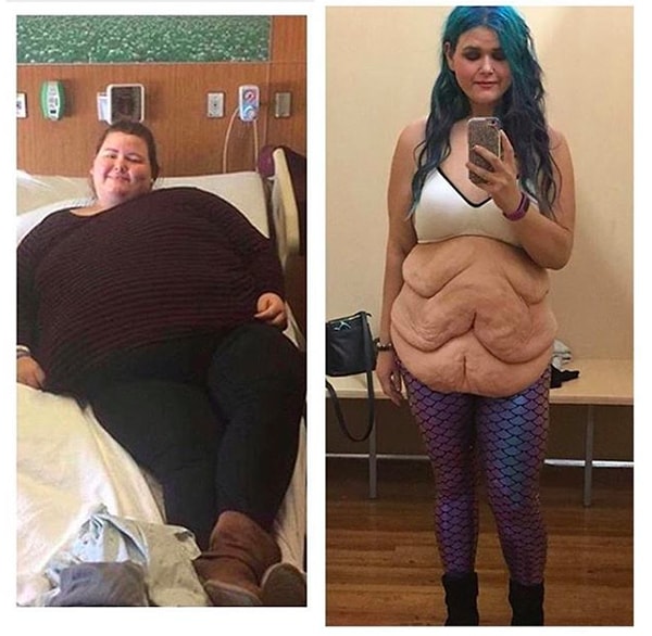 Но даже это не помогло ей сломать предрассудки людей в восприятии ее тела. Этой фотографией, которую Джессика опубликовала в своем профиле, она хотела возразить людям, считающим ее уродливой.