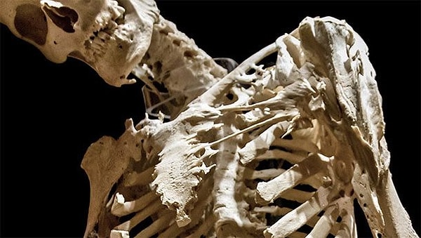 8. Харри Реймонд Истлек