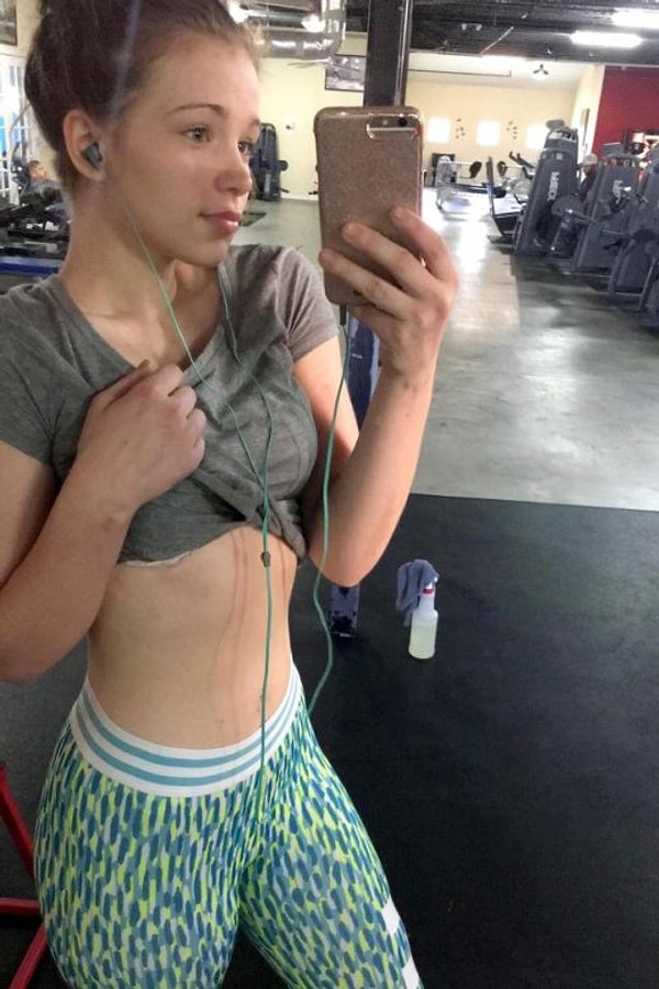 3. Что только не писали Рейне: ее называли обманщицей, больной анорексией и даже мошенницей.