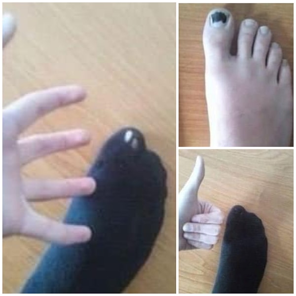 13. Зачем выкидывать любимые носки с дыркой на пальце, когда можно решить вопрос с помощью черного фломастера и элементарной смекалки? 😝