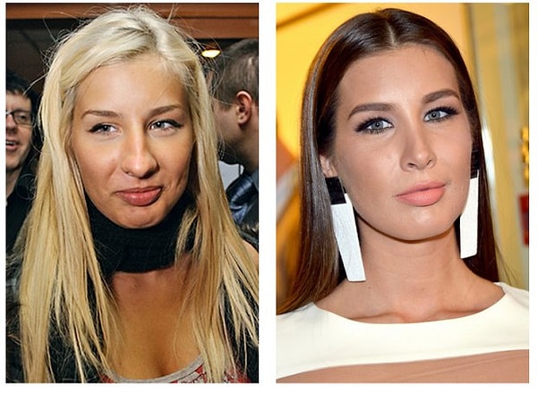 4. Кети Топурия