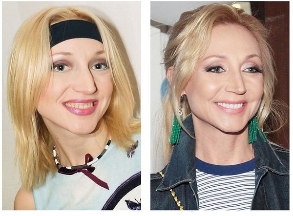 6. Кристина Орбакайте