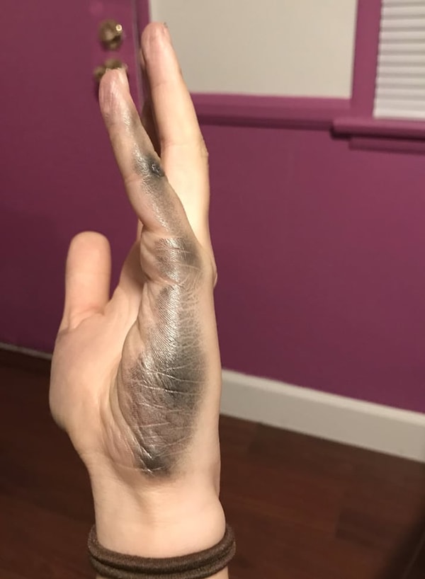 Такие пятна - это еще цветочки!