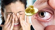 Ne Yapsanız Geçiremediğiniz Göz Kuruluğuna Çare Olacak Doğal Yöntemler
