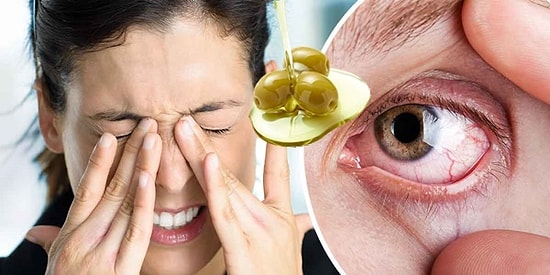 Ne Yapsanız Geçiremediğiniz Göz Kuruluğuna Çare Olacak Doğal Yöntemler