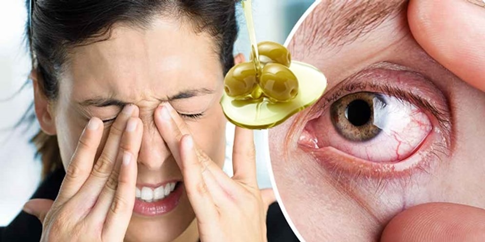 Ne Yapsanız Geçiremediğiniz Göz Kuruluğuna Çare Olacak Doğal Yöntemler