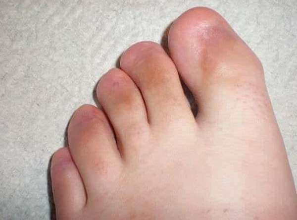 12. Ладно, верните накладные ногти