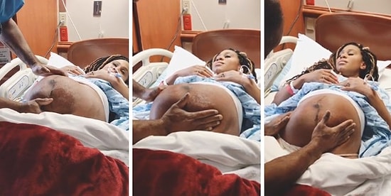 Anne Karnında Ters Dönmüş Bebeği Elleriyle Çeviren Doktor