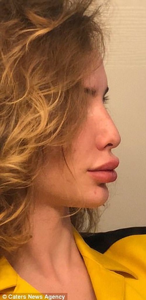 Kyleigh Potts trans bir birey. Ancak ameliyatları içerisinde cinsiyet değişikliği yok. Kendisi erkeklik organının kalmasını istemiş.