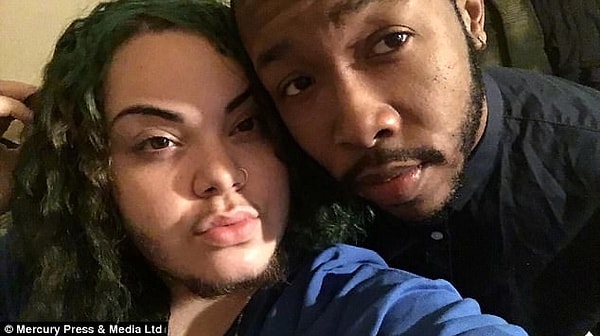 5. Когда Алма встретила своего 22-летнего парня Тейлора, она рассказал ему все. Тейлор оказал большую поддержку своей любимой в этой ситуации.