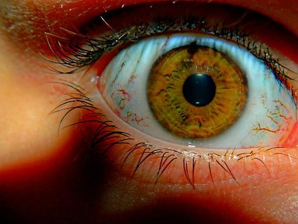 11. У вас может наблюдаться паранойя