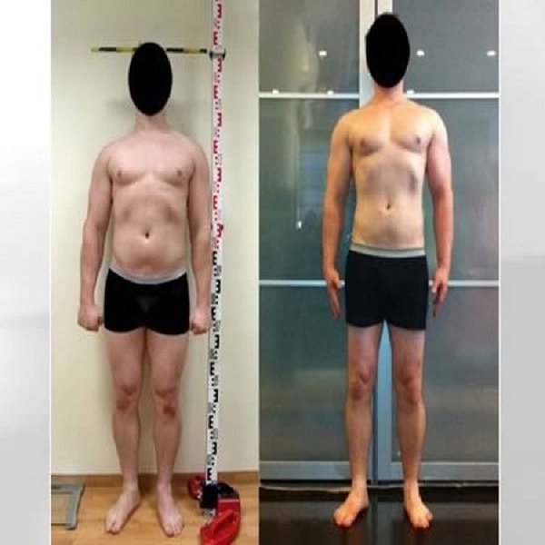 7. Мужчина, решивший стать выше, наплевав на боль