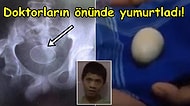Son İki Yıldır Düzenli Olarak Yumurtladığını İddia Eden Endonezyalı Çocuk Doktorları Şok Etti!