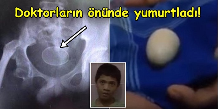 Son İki Yıldır Düzenli Olarak Yumurtladığını İddia Eden Endonezyalı Çocuk Doktorları Şok Etti!