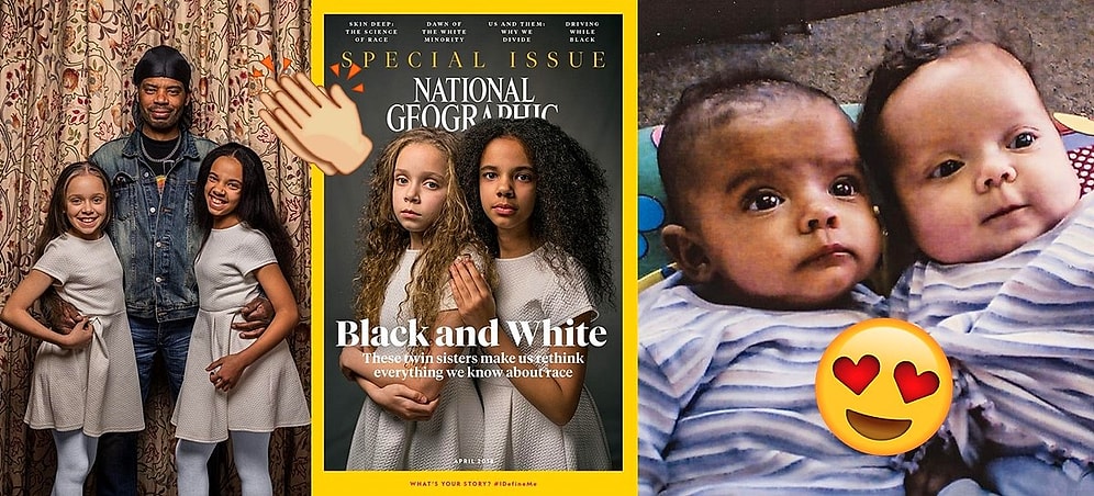 Нестандартная ситуация: как живут близнецы с разным цветом кожи?