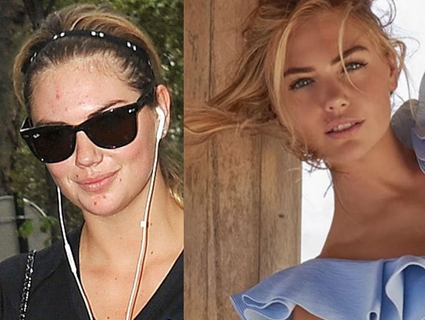 6. Кейт Аптон