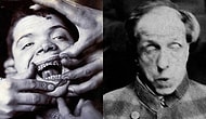 Bir Zamanlar Akıl Hastanelerinde Çekilmiş Bu 30 Fotoğraf Tüylerinizi Diken Diken Edecek!