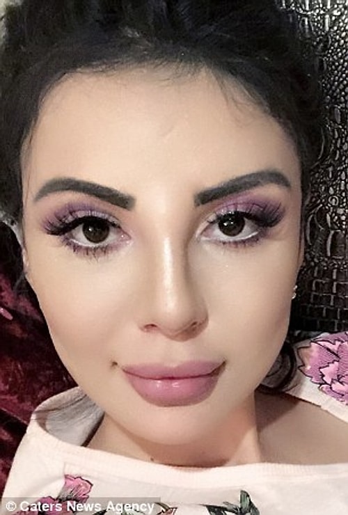 Jennifer, yaptırdığı son ameliyat için İstanbul'a seyahat etmiş ve Türk bir doktorun bıçağının altına yatmış. Bu operasyonda yanaklarındaki dolgular çıkartıldı ve ikinci bir burun estetiği yapıldı.
