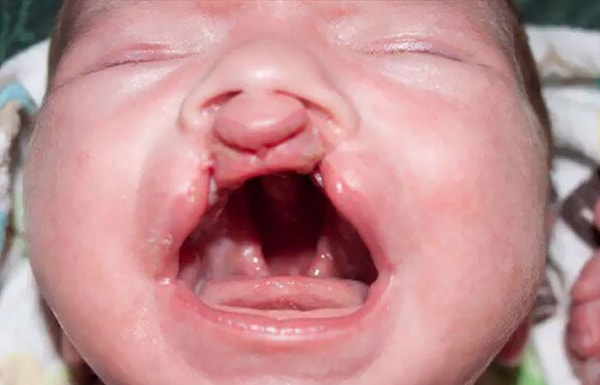 7. И еще несколько его ждут впереди.