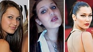 Umudunuzu Kaybetmeyin: Bella Hadid'in Estetik Öncesi Fotoğrafları İnterneti Altüst Etti
