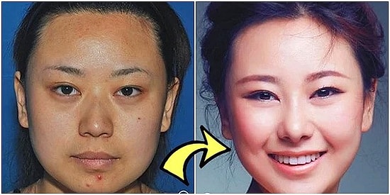Доктор, перекрои меня полностью: 17 ослепительных преображений кореянок "до и после"