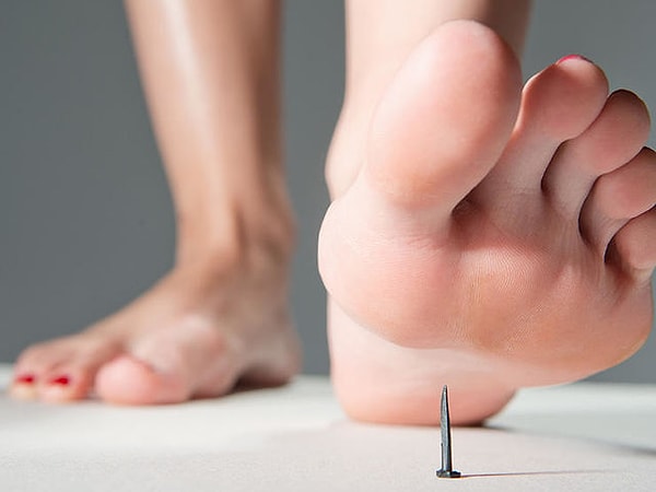 5. Вы вздрагиваете, когда видите это фото?