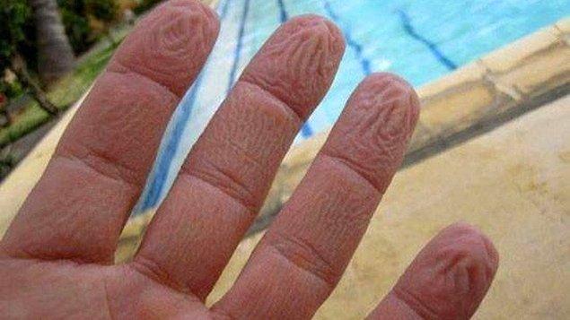9) Parmaklar suda kalınca neden buruşuyor?