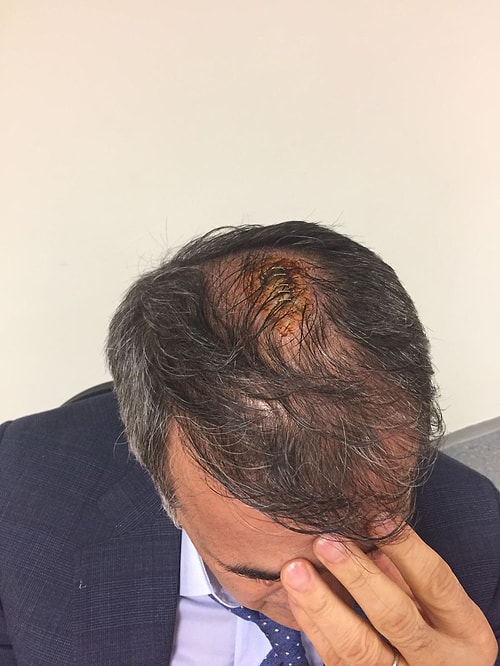 Şenol Güneş aldığı darbeden sonra 5 dikiş atılmasının ardından,