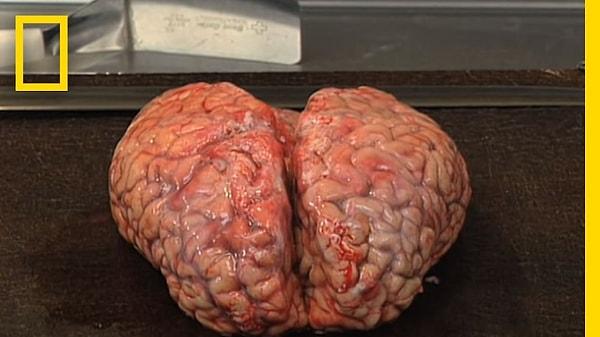12. Beyin organına karşı özel bir ilginiz varsa, Harvard Üniversitesi'ndeki 7000 beynin tutulduğu araştırma merkezini ziyaret edebilirsiniz.