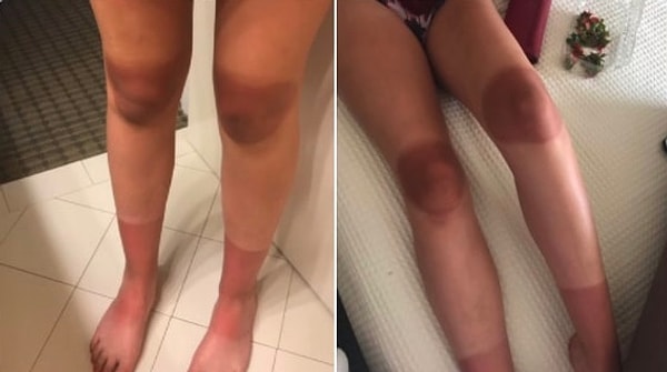 4. И только вы расслабились на летнем солнышке, как вас настигает эпический фейл!