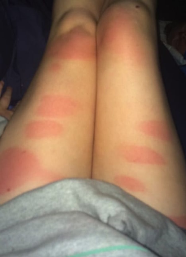 14. Они-то уж точно избавят вас от этого пятнистого загара!