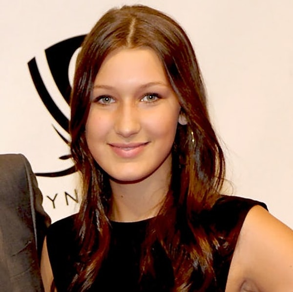 Да уж, хирургам пришлось изрядно потрудиться, чтобы довести внешность модели до совершенства.