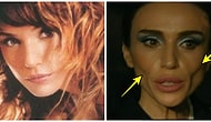 Günümüzün En Popüler Estetik Ameliyatlarından Biri Olan Hollywood Yanağı Yaptırıp Bambaşka Birine Dönüşen Ünlüler
