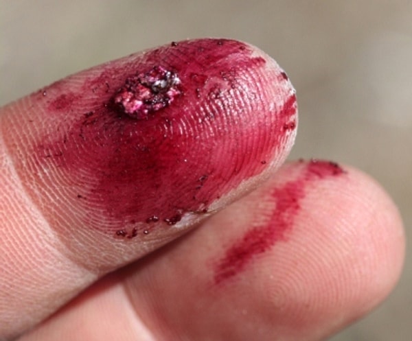 Другая точка зрения заключается в том, что эти насекомые не должны использоваться при производстве пищевых продуктов: