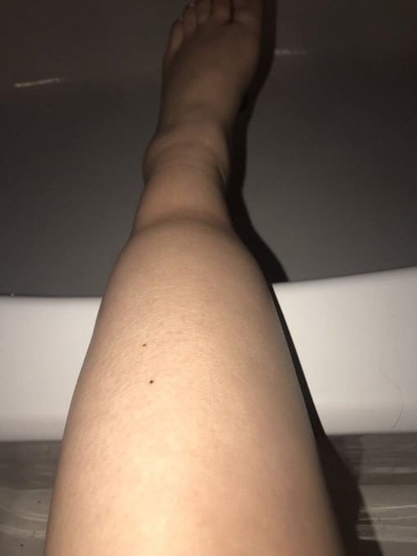 7. Когда поносила носки с тугой резинкой...