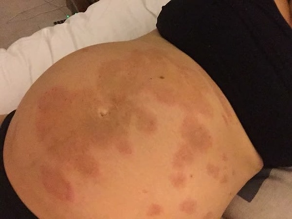 15. А вот последствия сильного зуда...