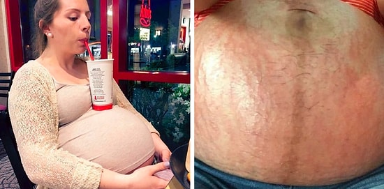 Эти 17 фото докажут, что беременность - это не всегда крутое и самое счастливое время в жизни женщины