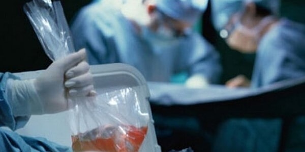 Türkiye'de böbrek ve karaciğer bekleyen 30 bin hasta var.