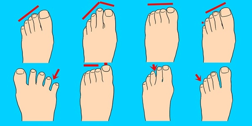 Vücudunda Bir Casus Var! Ayak Tipin Senin Kim Olduğunu Söylüyor!