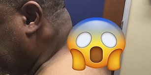 Sivilcelerin ve Aknelerin En Büyük Düşmanı Pimple Popper'dan Sevenlerine Hipnoz Etkili Video!