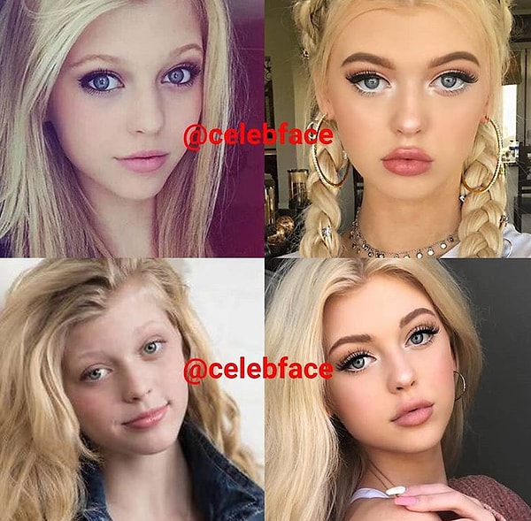 4. Вы не поверите, но этой девушке всего 16 лет! А она уже перекроила свое лицо