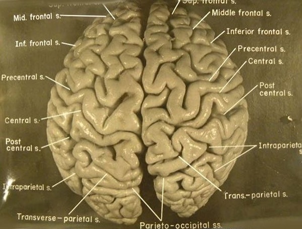 1. Мозг Альберта Эйнштейна нарезали на кубики