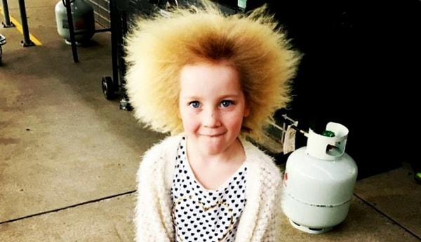 8. Многие дети рождаются с длинными волосами. А появляются они у плода 4-5 месяцев.