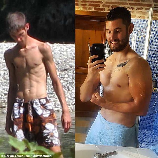 4. Вот что Дориан рассказывает о своем пищевом режиме во время анорексии: