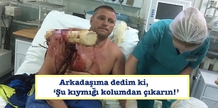 Kullandığı Uçak Ormana Düşünce Omzuna Bir Ağaç Saplanan Adamın İnanması Güç Umursamazlığı