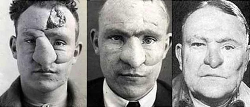 Yakın Tarihin Akıllara Durgunluk Veren 10 Dehşet Verici Deneyi